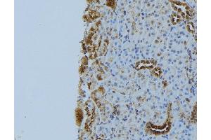 ABIN6272893 at 1/100 staining Mouse kidney tissue by IHC-P. (NBR1 Antikörper)