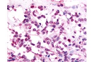 Immunohistochemistry (IHC) image for anti-Nuclear Receptor Subfamily 2, Group F, Member 6 (NR2F6) (Ligand Binding Domain) antibody (ABIN1049138)