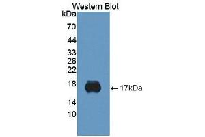 Detection of Recombinant SIGLEC10, Human using Monoclonal Antibody to Sialic Acid Binding Ig Like Lectin 10 (SIGLEC10) (SIGLEC10 Antikörper  (AA 571-697))