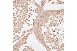 Immunohistochemistry (IHC) image for anti-VEGF Receptor 2 (VEGFR2) (AA 20-200) antibody (ABIN6142816)