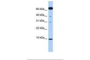 Image no. 1 for anti-Dynein, Light Chain, LC8-Type 1 (DYNLL1) (N-Term) antibody (ABIN6738836) (DYNLL1 Antikörper  (N-Term))