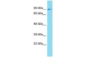 Western Blotting (WB) image for anti-Fibroblast Growth Factor Receptor 1 (FGFR1) (N-Term) antibody (ABIN2440842) (FGFR1 Antikörper  (N-Term))