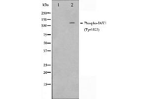Western blot analysis of JAK1 phosphorylation expression in A549 whole cell lysates,The lane on the left is treated with the antigen-specific peptide. (JAK1 Antikörper  (pTyr1022, pTyr1023))