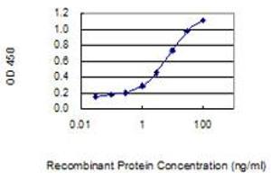 Detection limit for recombinant GST tagged WBSCR27 is 0. (WBSCR27 Antikörper  (AA 1-245))