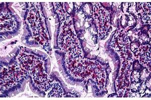 Rat Intestine: Formalin-Fixed, Paraffin-Embedded (FFPE) (GJB2 Antikörper  (Cytoplasmic Domain))