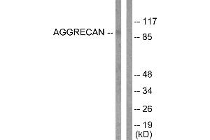 Western blot analysis of extracts from Jurkat cells, treated with Etoposide (25uM, 60mins), using Aggrecan (Cleaved-Asp369) antibody (#L0101). (Aggrecan Antikörper  (Cleaved-Asp369))