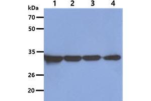 The Cell lysates (40ug) were resolved by SDS-PAGE, transferred to PVDF membrane and probed with anti-human OTUB1 antibody (1:5000). (OTUB1 Antikörper)