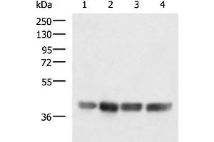 Western blot analysis of LOVO K562 Jurkat and Hela cell lysates using MRPS35 Polyclonal Antibody at dilution of 1:900 (MRPS35 Antikörper)