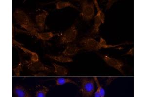 Immunofluorescence analysis of C6 cells using RPL27 Polyclonal Antibody at dilution of 1:100 (40x lens). (RPL27 Antikörper)
