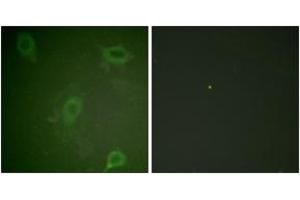 Immunofluorescence analysis of HeLa cells, using Amyloid beta A4 (Phospho-Thr743/668) Antibody.