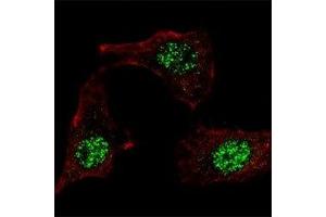 IF staining of HeLa cells with KLF4 antibody at 1:100, response is localized to the nuclei. (KLF4 Antikörper  (AA 69-101))