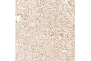 Immunohistochemistry (IHC) image for anti-DEAD (Asp-Glu-Ala-Asp) Box Polypeptide 6 (DDX6) (AA 1-50) antibody (ABIN7453871)
