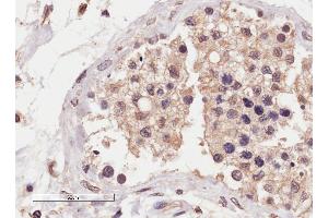 ABIN2559953 (4µg/ml) staining of paraffin embedded Human Testis. (SLC22A16 Antikörper  (Internal Region))