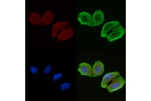 ABIN6256965 and ABIN6274452 staining Hela cells(30 min of UV treatment) by IF/ICC. (BRI3BP Antikörper  (N-Term))