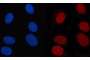 IF analysis of RANBP2 using anti-RANBP2 antibody (ABIN7602650). (RANBP2 Antikörper  (AA 906-2744))