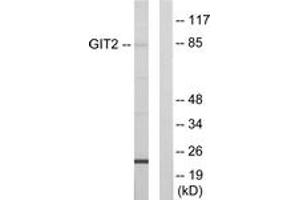 Western blot analysis of extracts from HepG2 cells, using GIT2 Antibody. (GIT2 Antikörper  (AA 361-410))