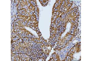 IHC analysis of CD147/Emmprin using anti-CD147/Emmprin antibody (ABIN7599999). (CD147 Antikörper  (AA 138-323))