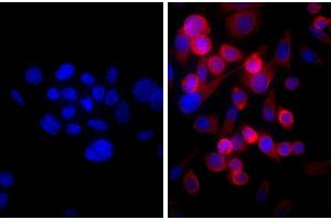 Human pancreatic carcinoma cell line MIA PaCa-2 was stained with Mouse Anti-Cytokeratin 18-UNLB and DAPI. (Ziege anti-Maus IgG (Heavy & Light Chain) Antikörper (HRP) - Preadsorbed)