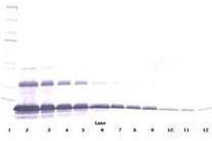 Image no. 3 for anti-Tumor Necrosis Factor Receptor Superfamily, Member 1A (TNFRSF1A) antibody (ABIN465075) (TNFRSF1A Antikörper)