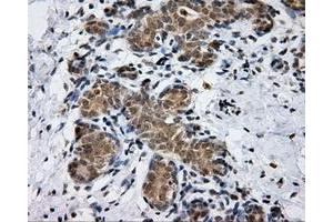 Immunohistochemical staining of paraffin-embedded breast tissue using anti-PTPRE mouse monoclonal antibody. (PTPRE Antikörper)