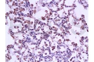 Immunohistochemistry (IHC) image for anti-Signal Transducer and Activator of Transcription 3 (Acute-Phase Response Factor) (STAT3) (AA 233-330) antibody (ABIN738261)