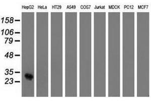 Image no. 2 for anti-OTU Domain, Ubiquitin Aldehyde Binding 2 (OTUB2) antibody (ABIN1499937)