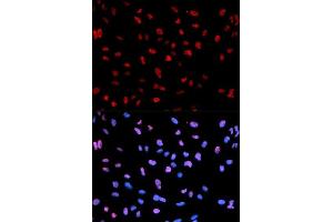 Immunofluorescence analysis of U2OS cells using Phospho-MEF2C-S396 antibody. (MEF2C Antikörper  (pSer396))