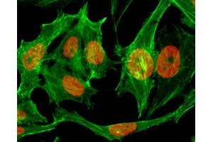 ICC/IF testing of human HeLa cells treated with sodium butyrate using recombinant H3K9me1 antibody (red). (Rekombinanter Histone 3 Antikörper  (H3K9me1))