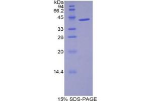 SDS-PAGE analysis of Mouse WFDC5 Protein. (WFDC5 Protein)