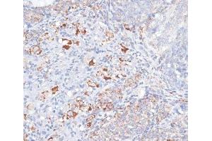 Immunohistochemistry of paraffin-embedded Rat ovary using SMPD1 / ASM Polyclonal Antibody at dilution of 1:100 (40x lens). (SMPD1 Antikörper)