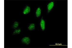 Immunofluorescence of purified MaxPab antibody to IPPK on HeLa cell. (IPPK Antikörper  (AA 1-491))