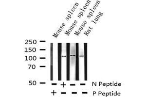 Western blot analysis of Phospho-NF kappaB p100/p52 (Ser869) expression in various lysates (NFKB2 Antikörper  (pSer870))