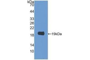 Detection of Recombinant GAL2, Rat using Polyclonal Antibody to Galectin 2 (GAL2) (Galectin 2 Antikörper  (AA 1-130))