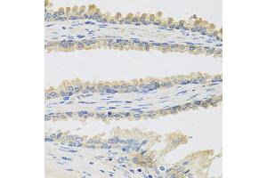 Immunohistochemistry of paraffin-embedded human prostate using INSL3 antibody at dilution of 1:100 (40x lens). (INSL3 Antikörper)