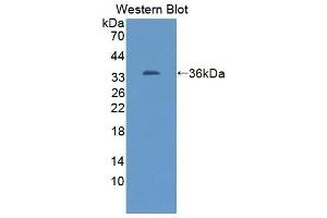 Detection of Recombinant Kim1, Rat using Polyclonal Antibody to Kidney Injury Molecule 1 (Kim1)