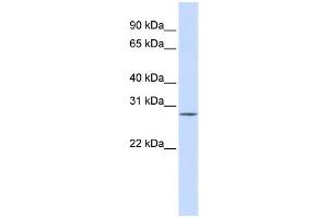 WB Suggested Anti-SPI1 Antibody Titration:  0. (SPI1 Antikörper  (Middle Region))