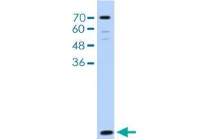 Western blot analysis of HepG2 cell lysate with LSM2 polyclonal antibody . (LSM2 Antikörper  (AA 46-95))