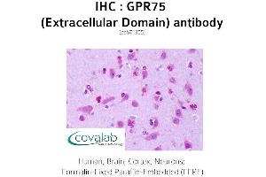 Image no. 1 for anti-G Protein-Coupled Receptor 75 (GPR75) (2nd Extracellular Domain) antibody (ABIN1735159) (GPR75 Antikörper  (2nd Extracellular Domain))