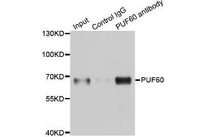 Immunoprecipitation analysis of 150 μg extracts of A549 cells using 3 μg PUF60 antibody (ABIN5974052). (PUF60 Antikörper)