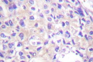 Image no. 1 for anti-Ribosomal Protein S6 Kinase, 90kDa, Polypeptide 1 (RPS6KA1) antibody (ABIN271935) (RPS6KA1 Antikörper)