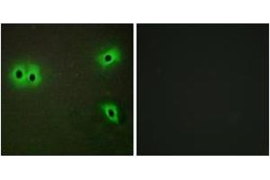 Immunofluorescence analysis of A549 cells, using Collagen XIII alpha1 Antibody.