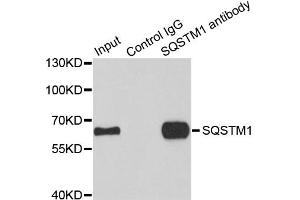 Immunoprecipitation analysis of 100ug extracts of HepG2 cells using 3ug SQSTM1 antibody. (SQSTM1 Antikörper)