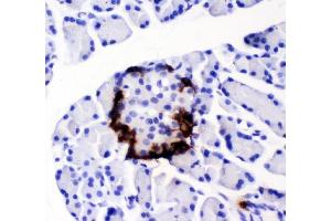 IHC analysis of Peptide YY using anti-Peptide YY antibody (ABIN4886709).