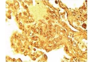 Image no. 1 for anti-serine Palmitoyltransferase, Long Chain Base Subunit 1 (SPTLC1) antibody (ABIN4620353) (SPTLC1 Antikörper)