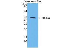 Western blot analysis of the recombinant protein. (TLR10 Antikörper  (AA 20-250))