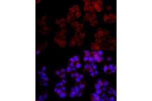 Immunofluorescence analysis of HepG2 cells using NUDT5 Rabbit mAb (ABIN7269071) at dilution of 1:100 (40x lens). (NUDT5 Antikörper)