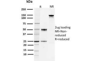SDS-PAGE Analysis Purified PD-L1 Mouse Monoclonal Antibody (PDL1/2744). (PD-L1 Antikörper  (AA 39-191))