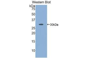 Western blot analysis of the recombinant protein. (KNG1 Antikörper  (AA 390-644))