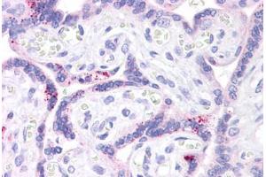 Immunohistochemistry (Formalin-fixed Paraffin-embedded Sections) (IHC (fp)) image for anti-ATP-Binding Cassette, Sub-Family B (MDR/TAP), Member 1 (ABCB1) (AA 863-912) antibody (ABIN6745748)