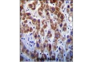GOG8A Antibody (N-term) (ABIN655146 and ABIN2844767) immunohistochemistry analysis in formalin fixed and paraffin embedded human liver tissue followed by peroxidase conjugation of the secondary antibody and DAB staining.